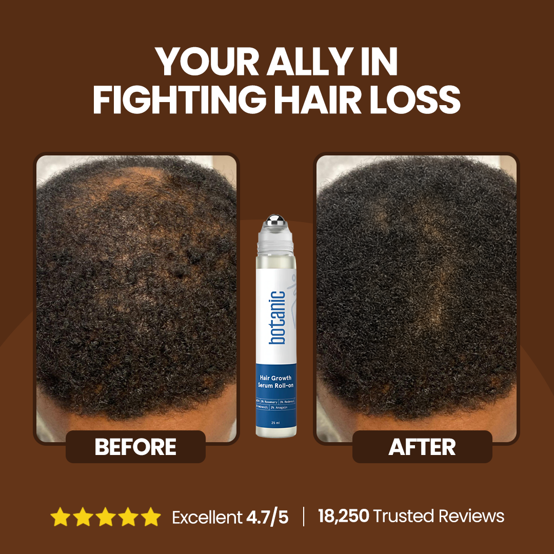 Patented Hair Growth Roll-On Serum