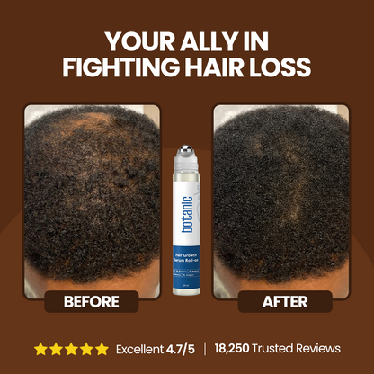 Patented Hair Growth Roll-On Serum