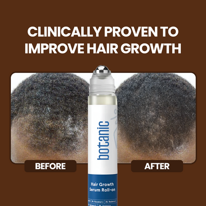 Patented Hair Growth Roll-On Serum